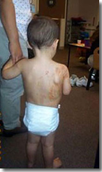 Effects of meth on children